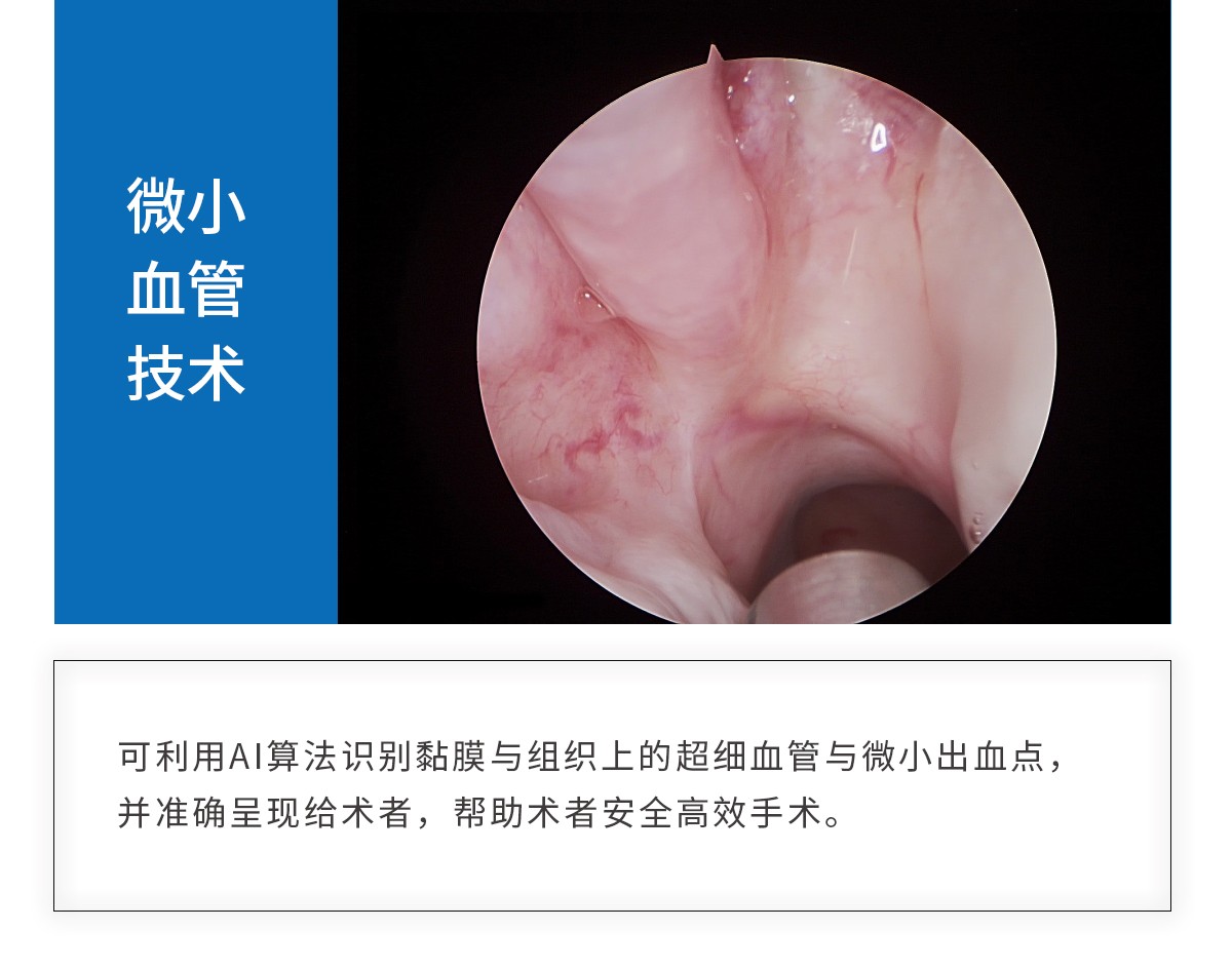 【4K醫(yī)用內(nèi)窺鏡攝像系統(tǒng)】您的第一臺“4K”找到了嗎？