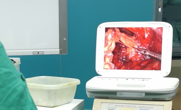 【腹腔鏡篇】腹腔鏡疝氣手術(shù)，您知道嗎？